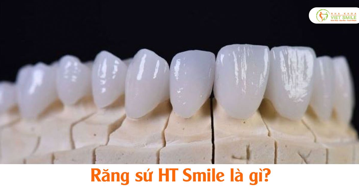 Răng sứ ht smile là gì?