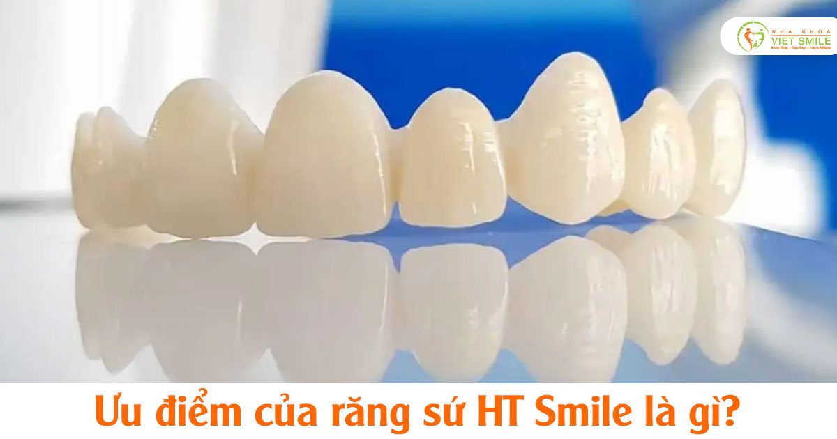 Răng sứ ht smile sử dụng khi nào?