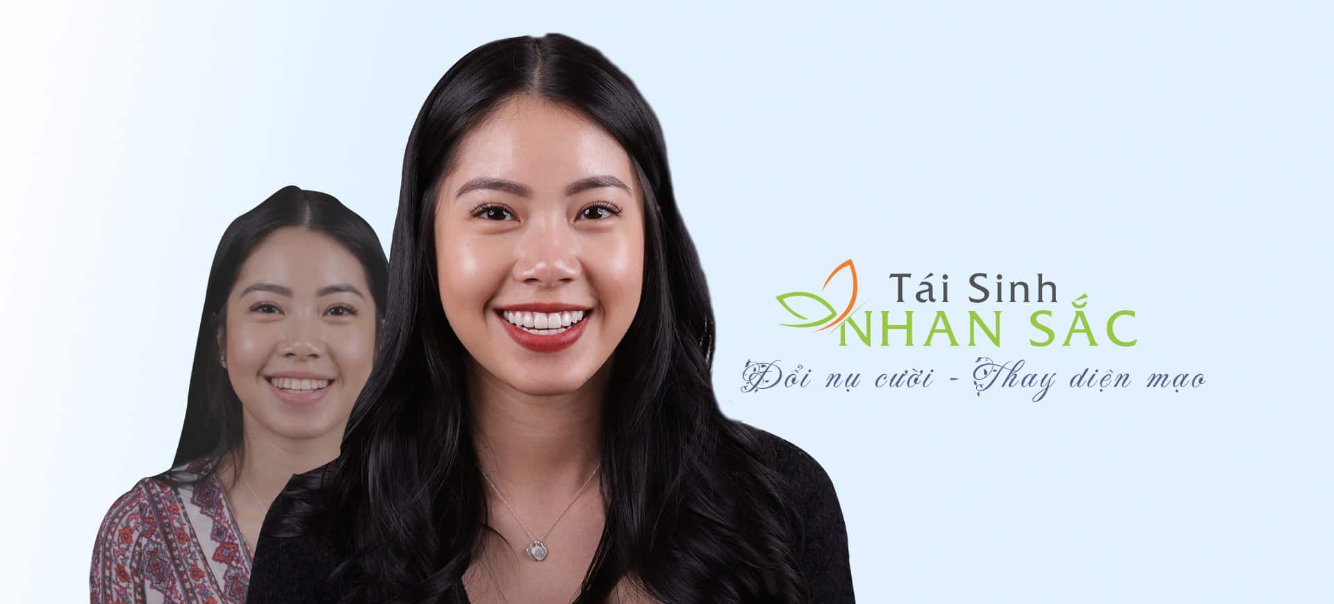 Dán sứ veneer giá bao nhiêu? 1 Dán sứ veneer giá bao nhiêu luôn là câu hỏi được đông đảo người tìm kiếm