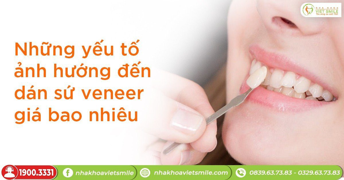 Răng dán sứ veneer giá bao nhiêu? - bảng giá dán sứ mới nhất 11 Những yếu tố ảnh hưởng đến dán sứ veneer giá bao nhiêu?