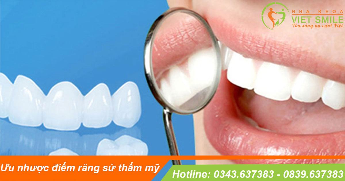 Ưu nhược điểm các loại răng sứ thẩm mỹ mới nhất 2020? Dán sứ veneer nên chọn loại nào? 2 Loại răng sứ thẩm mỹ nào tốt nhất?