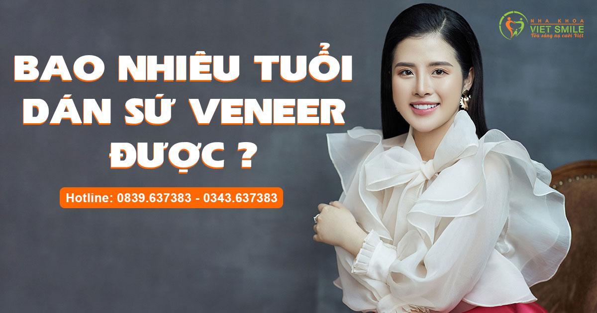 Bao nhiêu tuổi dán sứ veneer được? 1 Bao nhieu tuoi dan su veneer dươc