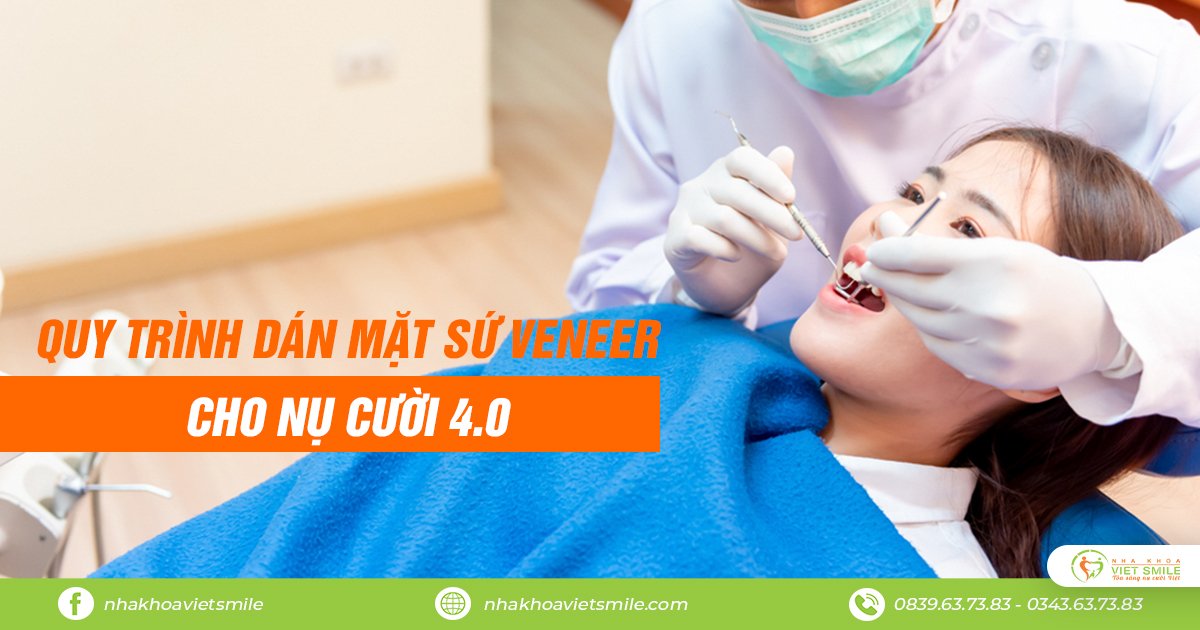 Quy trình dán mặt sứ veneer cho nụ cười 4. 0 1 Dán mặt sứ veneer