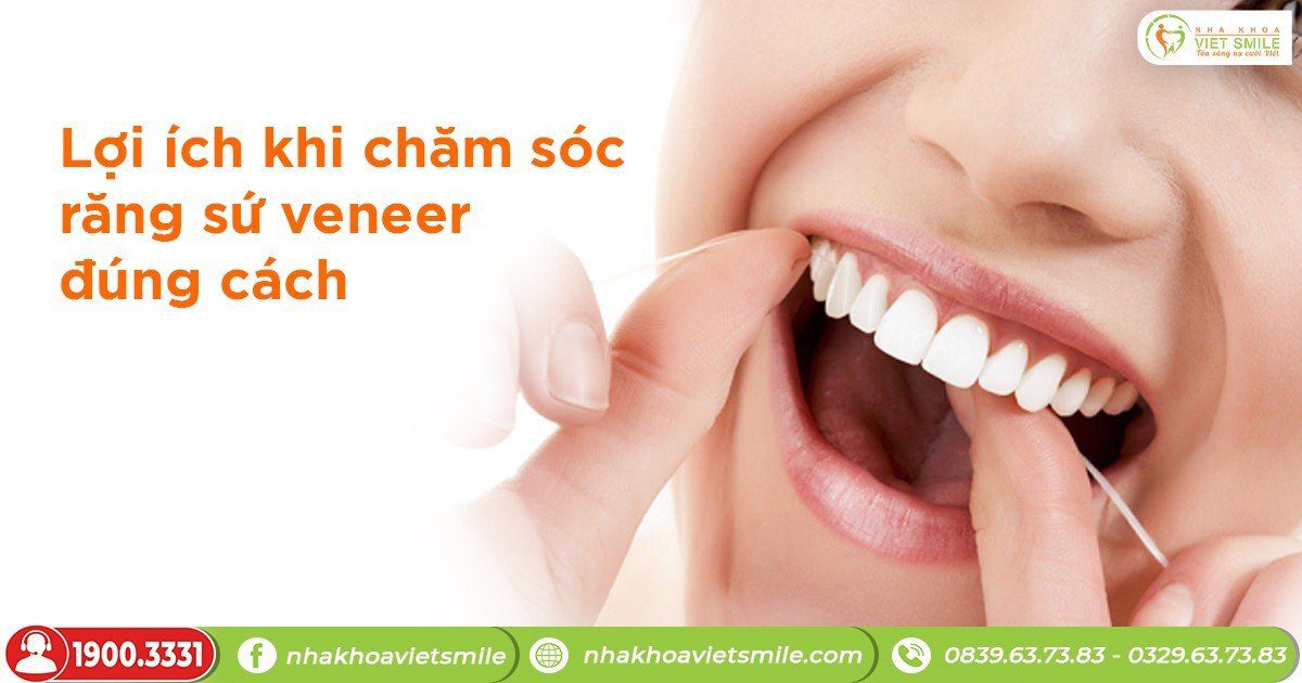 Lợi ích khi chăm sóc răng sứ veneer đúng cách