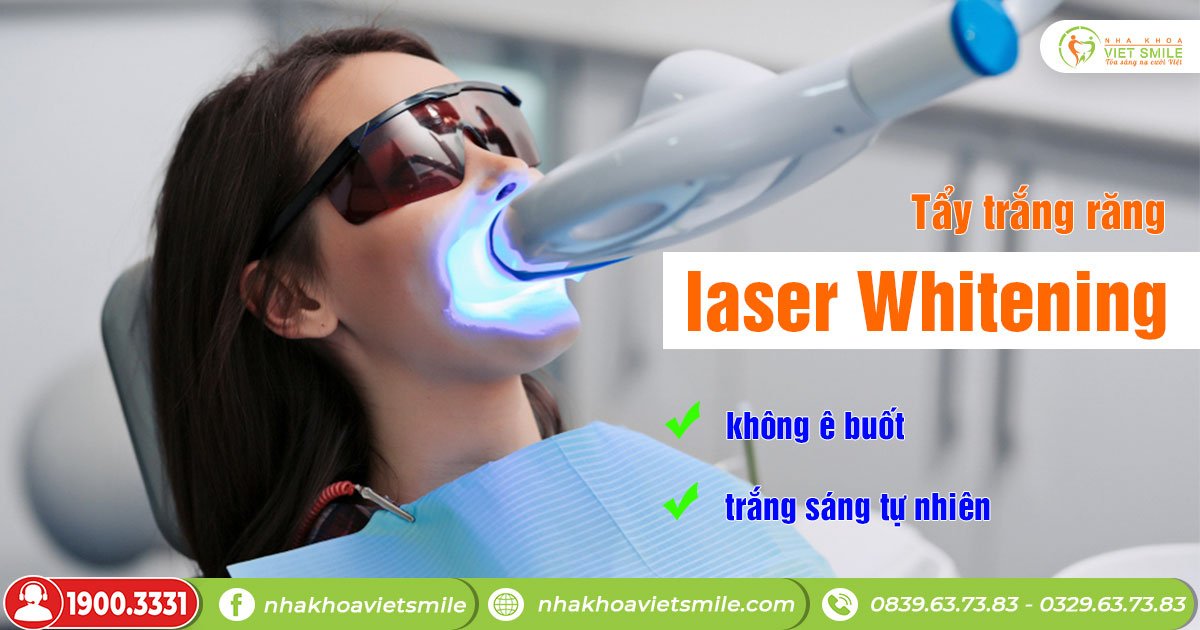 Công nghệ laser whitening tại việt smile