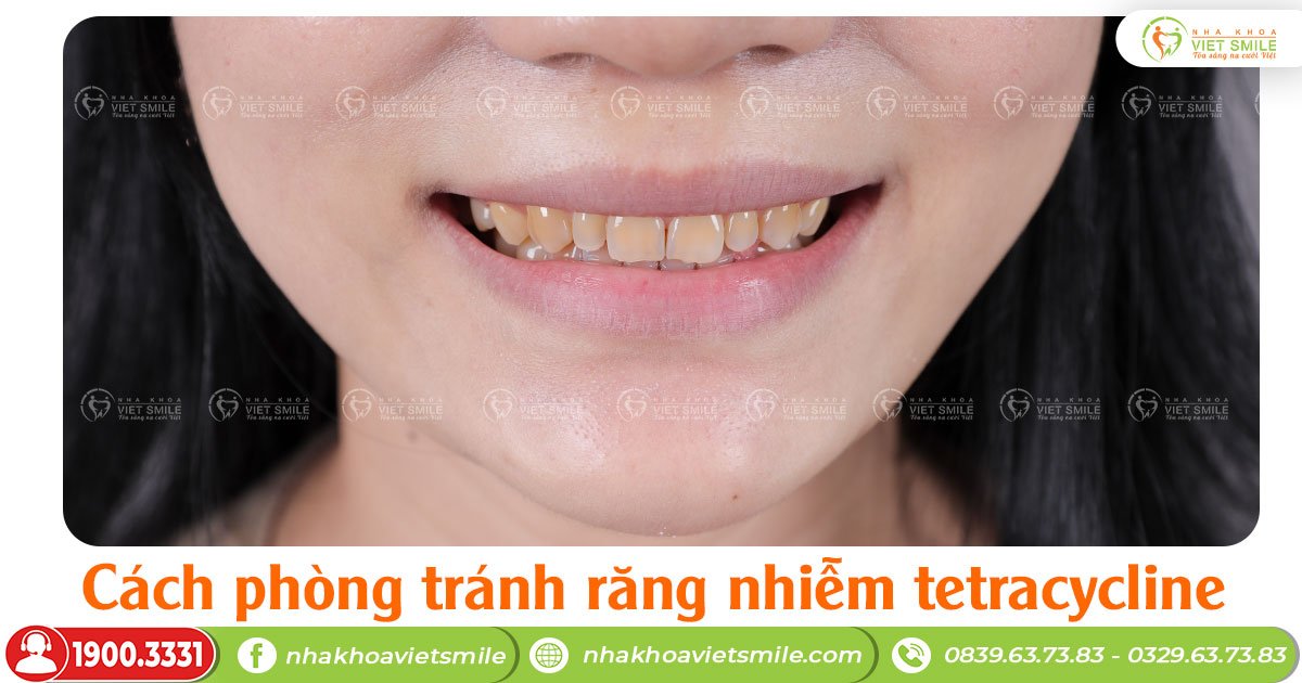 Cách phòng tránh răng nhiễm tetracycline
