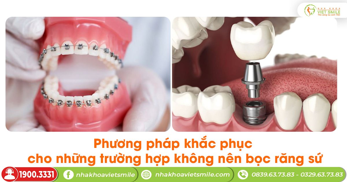 Phương pháp khắc phục cho những trường hợp không nên bọc răng sứ