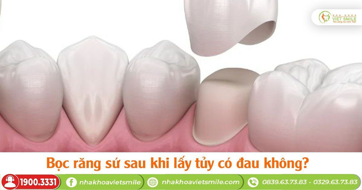 Bọc răng sứ sau khi lấy tủy có đau không?