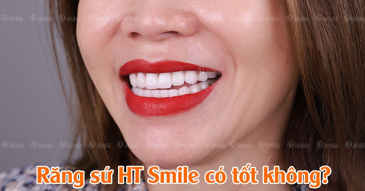 Răng sứ ht smile có tốt không?