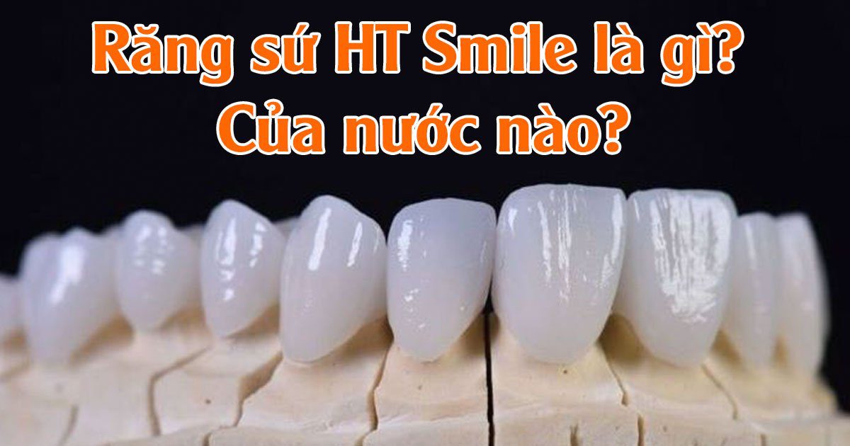Răng sứ ht smile là gì?