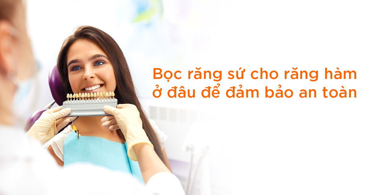 Bọc răng sứ cho răng hàm ở đâu để đảm bảo an toàn