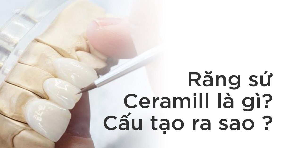 Răng sứ ceramill là gì? Cấu tạo ra sao?