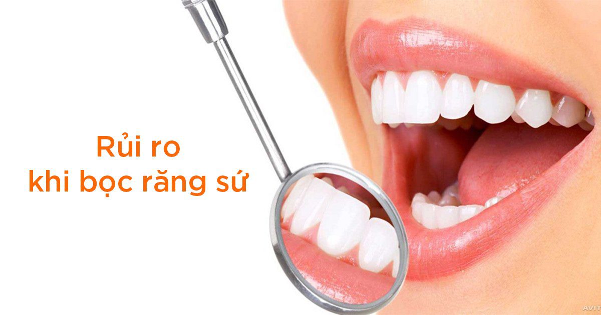 Rủi ro khi bọc răng sứ