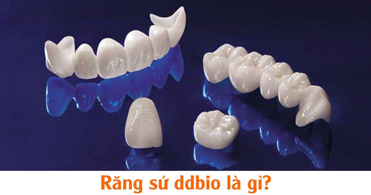 Răng sứ ddbio là gì?