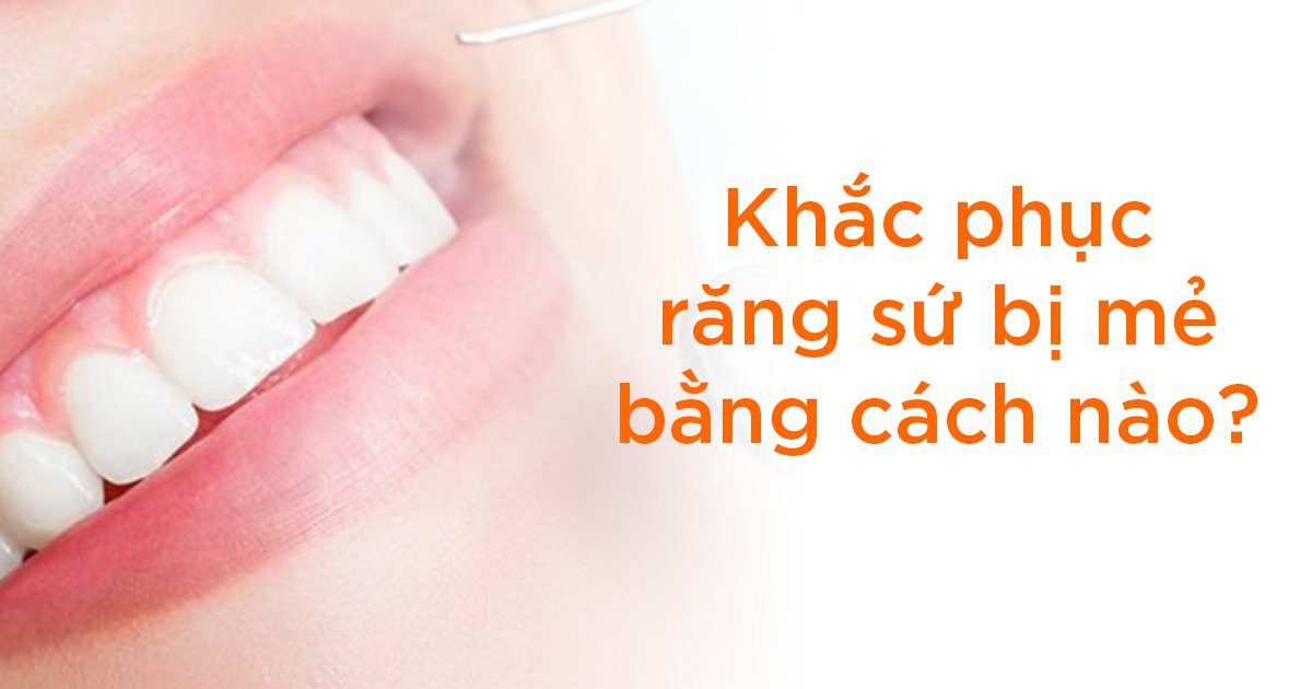 Khắc phục răng sứ bị mẻ bằng cách nào?