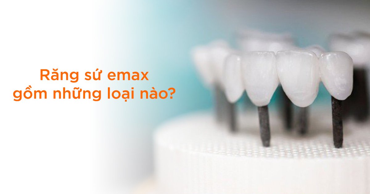 Răng sứ emax gồm những loại nào?