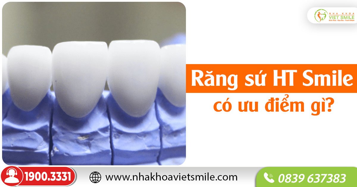 Răng sứ ht smile có ưu điểm gì?