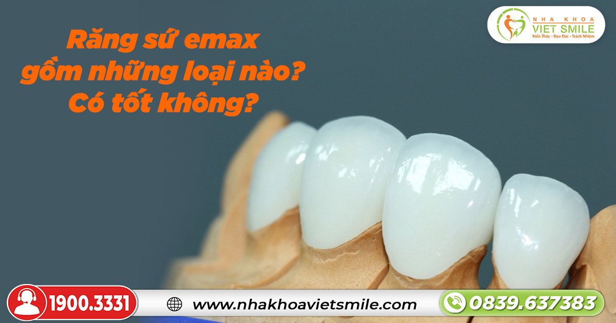 Răng sứ emax gồm những loại nào? Có tốt không?