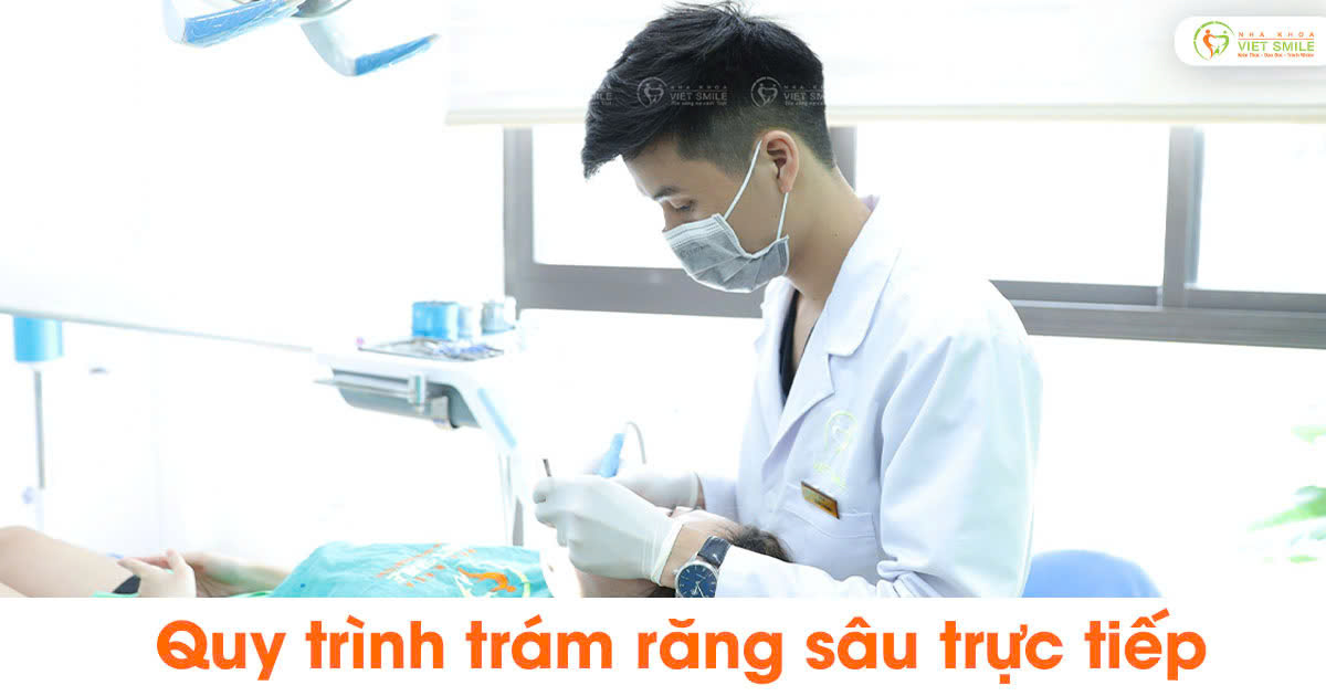 Quy trình trám răng sâu trực tiếp