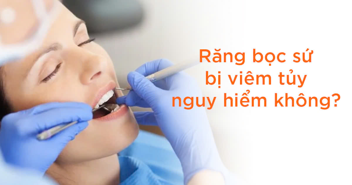 Răng bọc sứ bị viêm tủy nguy hiểm không?