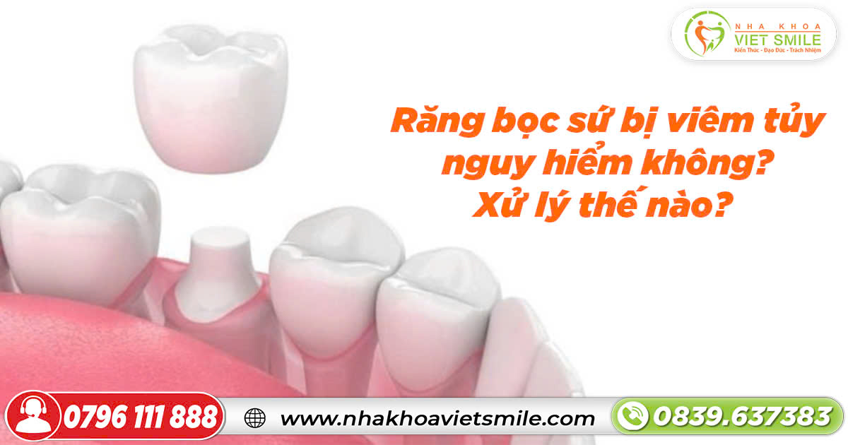 Răng bọc sứ bị viêm tủy nguy hiểm không? Xử lý thế nào?