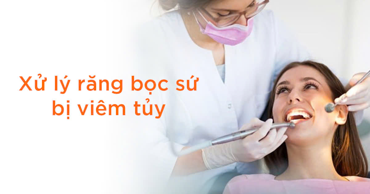 Xử lý răng bọc sứ bị viêm tủy