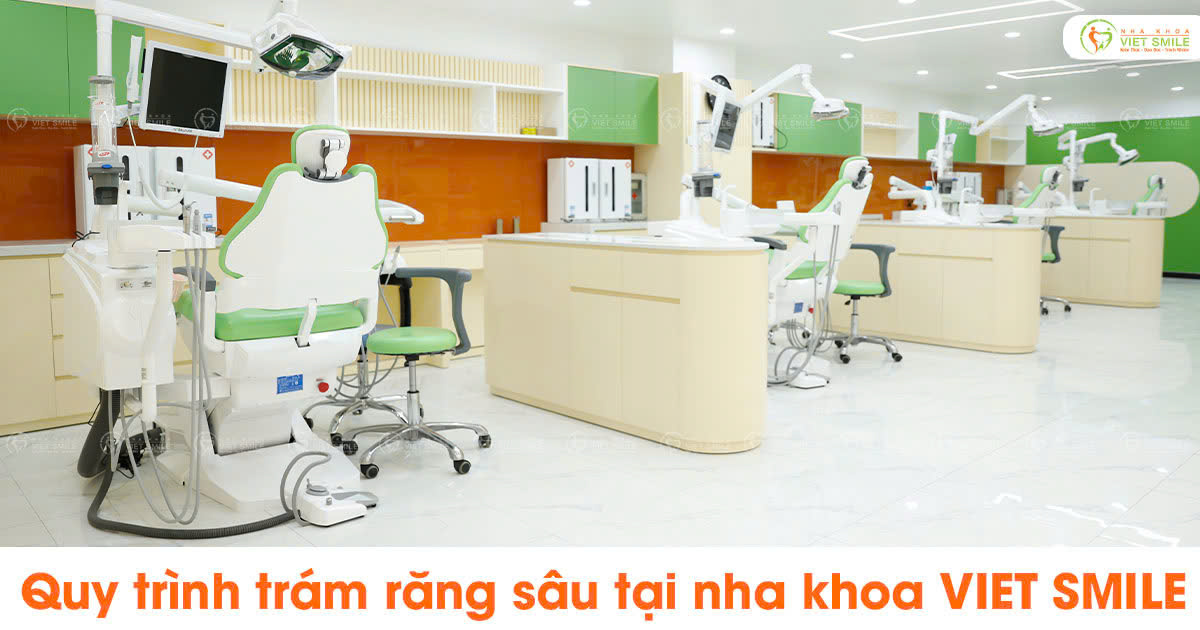 Quy trình trám răng sâu tại nha khoa viet smile