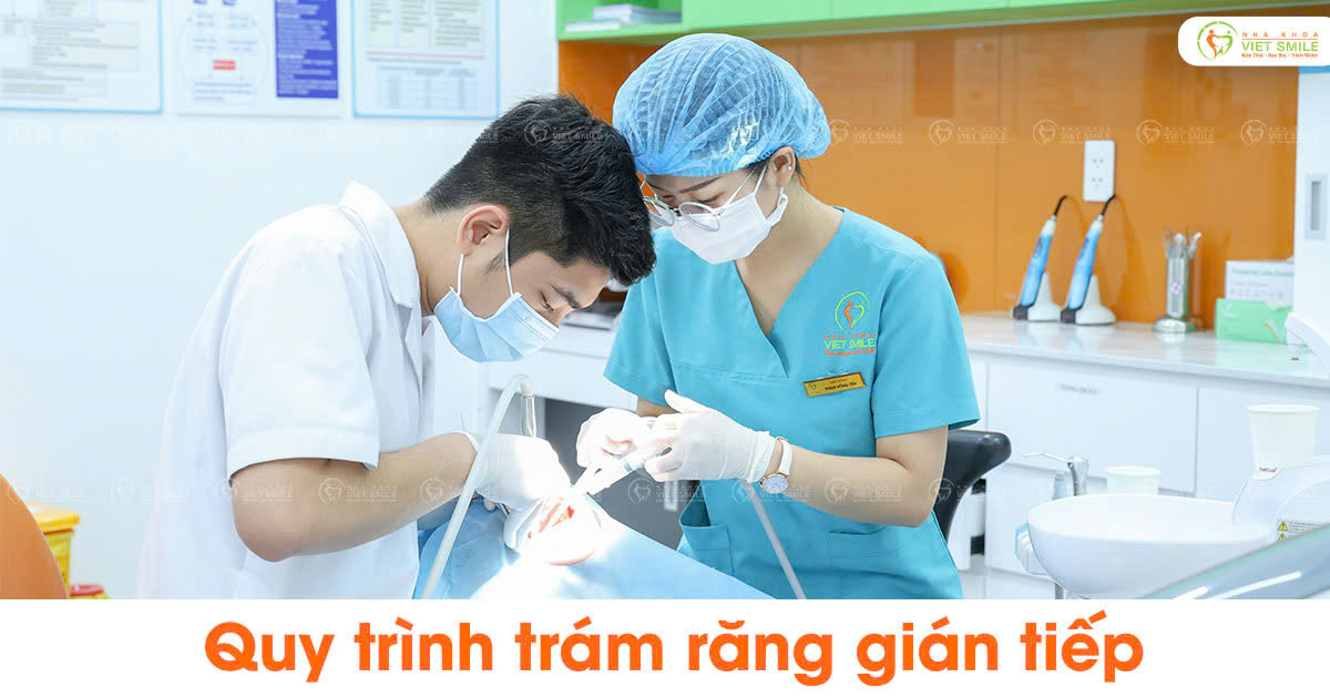 Quy trình trám răng gián tiếp