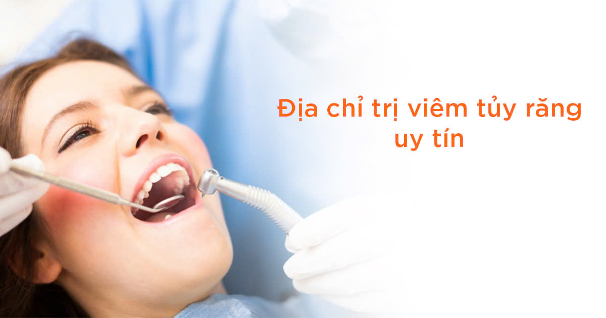 Địa chỉ trị viêm tủy răng uy tín