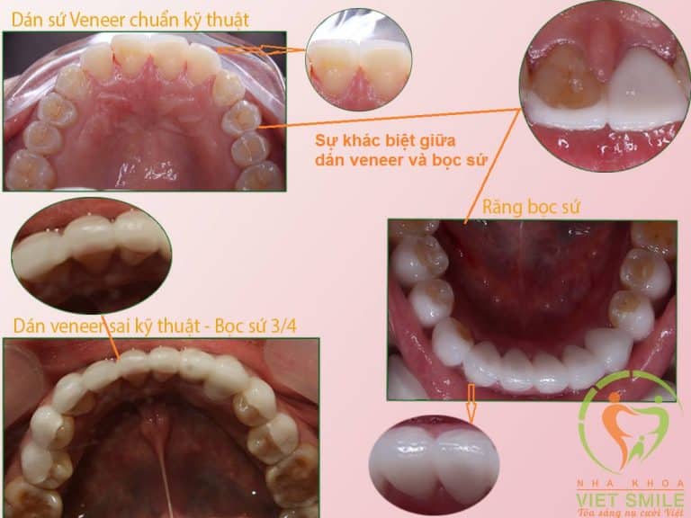 Cẩn hiểu đúng về các phương pháp làm răng thẩm mỹ